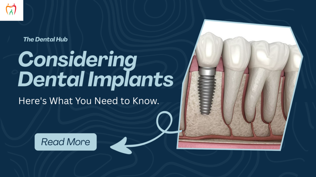 Considering Dental Implants? Here’s What You Need to Know.