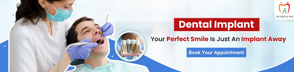 dental implant banner