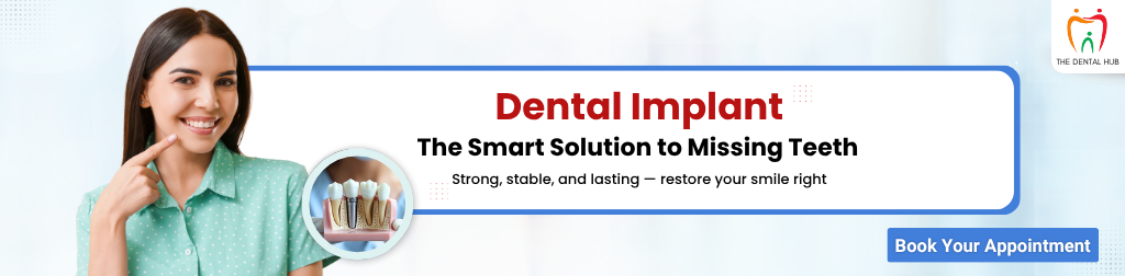 dental implants banner dentalhub 